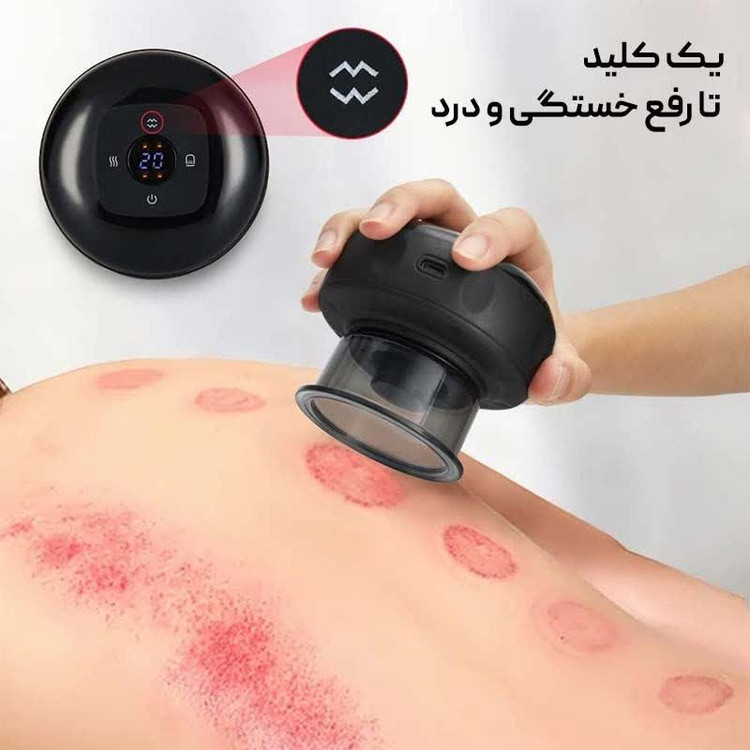 دستگاه بادکش برقی مدل NG-122